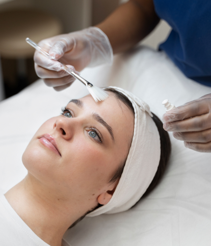 Professional Chemical Peels